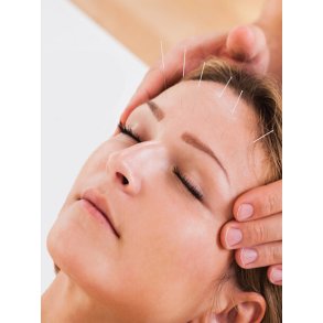 Akupunktur-uddannelse