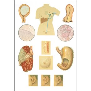 Cancer. Planche 84x118 cm.