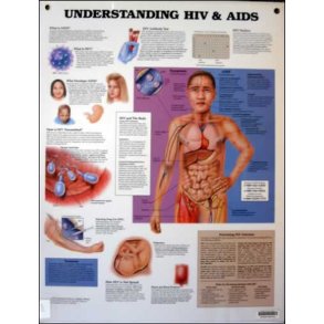 HIV & Aids. Anatomisk plakat 50x67 cm. Lamineret med lister.
