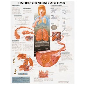 Astma. Anatomisk plakat 50x67 cm. Lamineret med lister.