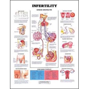 Barnlshed. Anatomisk plakat 50x67 cm. Lamineret med lister.