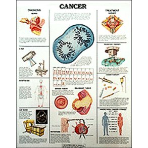 Cancer II. Anatomisk plakat 50x67 cm. Lamineret med lister.