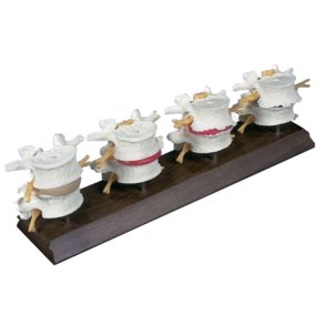 Degeneration af ryghvirvler