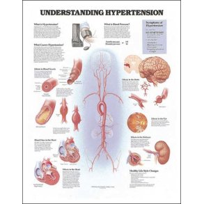 Forhjet blodtryk. Anatomisk plakat 50x67 cm. Lamineret med lister.