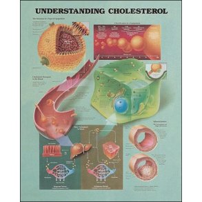Kolesterol. Anatomisk plakat 50x67 cm. Lamineret med lister.