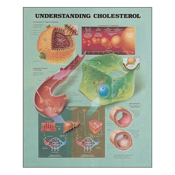 Kolesterol. Anatomisk plakat 50x67 cm. Lamineret med lister.