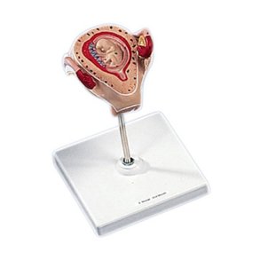 Livmoder med foster 2 mneder gammelt