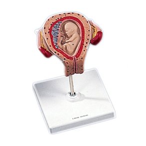 Livmoder med foster 3 m�neder gammelt