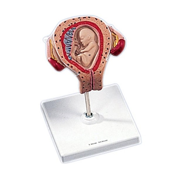 Livmoder med foster 3 mneder gammelt