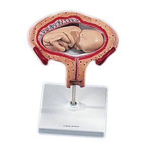 Livmoder med foster i 4-5. m�ned. Pr�sentation med �t ben op langs kroppen.