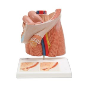 Lyskebrok (inguinal hernie)