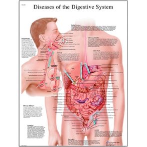 Sygdomme i fordjelses systemet. Anatomisk plakat.