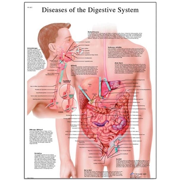 Sygdomme i fordjelses systemet. Anatomisk plakat.