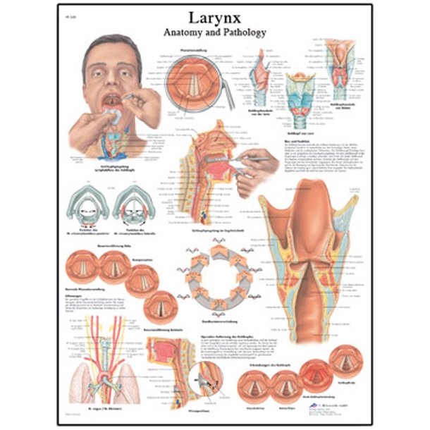 Strubens (larynx) anatomi og patologi. Anatomisk plakat.