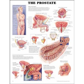 Prostata. Anatomisk plakat 50x67 cm. Lamineret med lister.