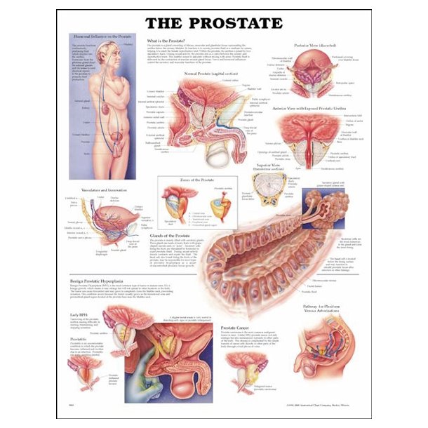 Prostata. Anatomisk plakat 50x67 cm. Lamineret med lister.