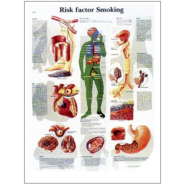 Rygning og sygdom. Anatomisk plakat 50x67 cm.