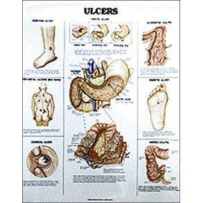 Sr. Anatomisk plakat 50x67 cm. Lamineret med lister.