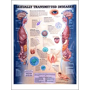 Knssygdomme. Anatomisk plakat 50x67 cm. Lamineret med lister.
