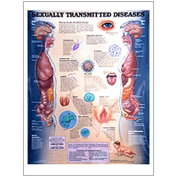 Kønssygdomme. Anatomisk plakat 50x67 cm. Lamineret med lister.
