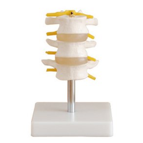 3 lndehvirvler p stativ